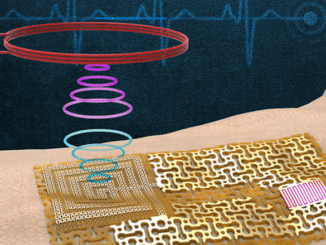 electronic skin